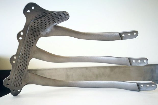 3D Printed Titanium Prosthesis Used In Chest Wall Reconstruction ...